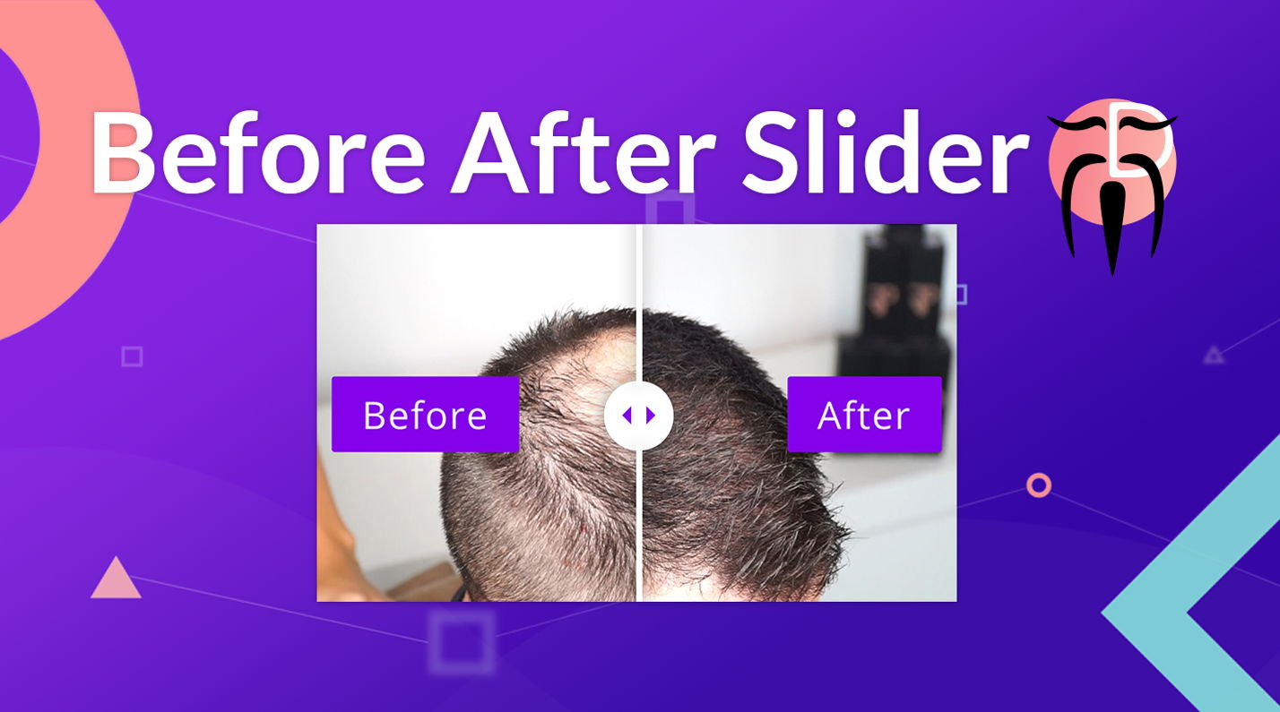 Divi Sensei Before After Slider v2.2.2（已汉化） – Wp Divi前后对比图插件插图